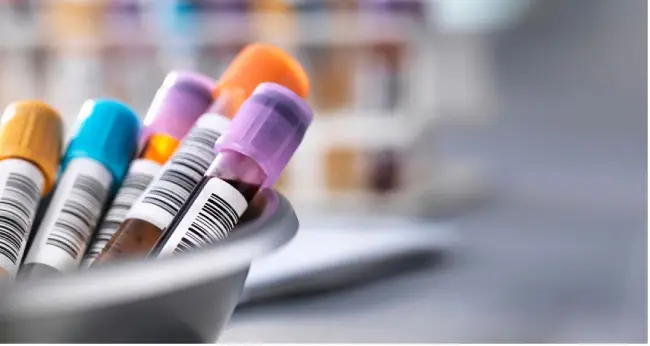 1D-barcode-challenges