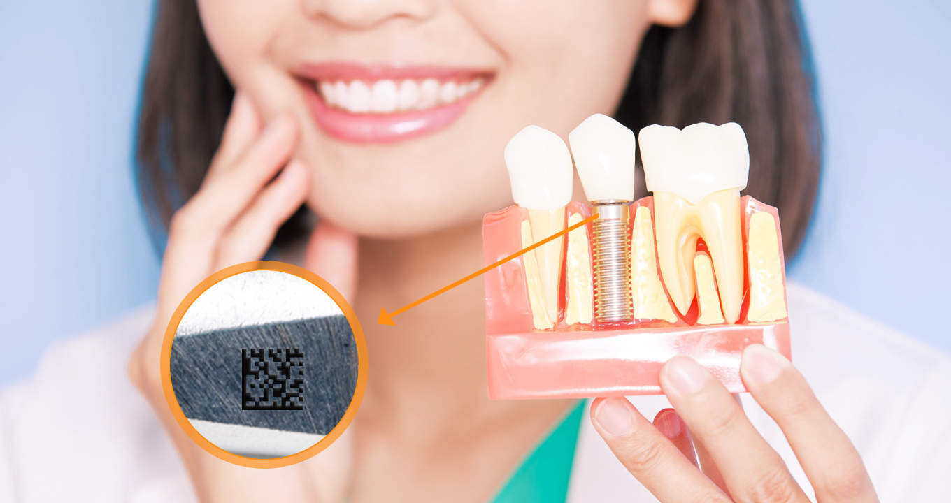 dpm-on-dental-implants