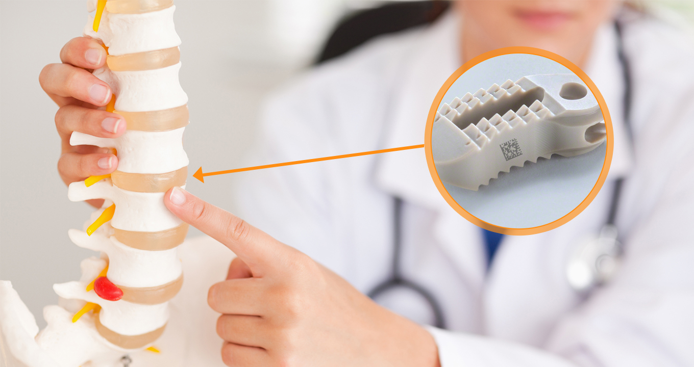 peek-solution-in-medical