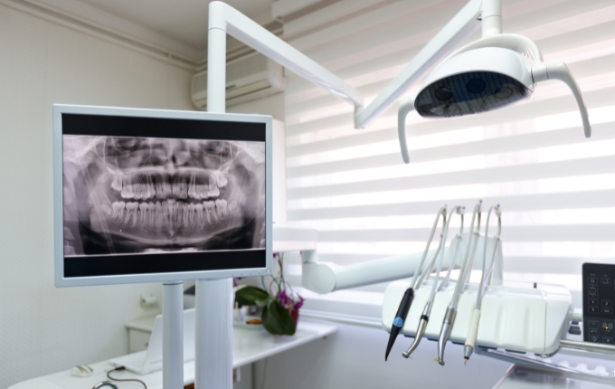 Dental-X-ray
